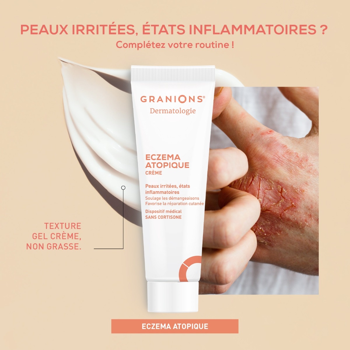 Crème dermatologie eczéma atopique - 30 ml